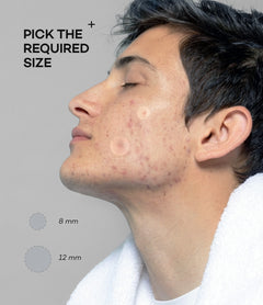 Acne Pimple Patches (36 pcs)