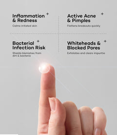Acne Pimple Patches (36 pcs)