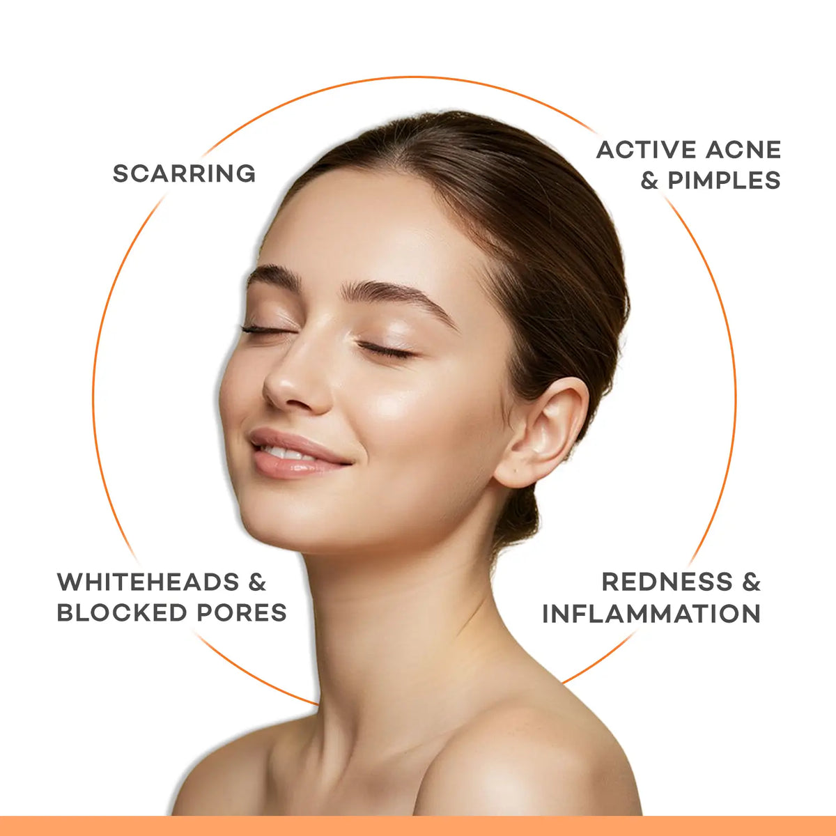 Acne Patch - Image 3